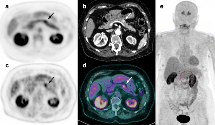 Best F-DOPA PET Scan Center Near Me