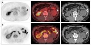 Best Center for F-Conal FDG PET Scan Near Me