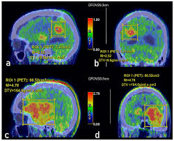 Best F-DOPA PET Scan Center Near Me