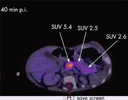 Affordable F-DOPA PET Scan Services
