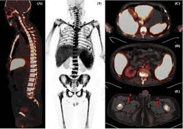 Best FDG PET CT Scan in Greater Kailash