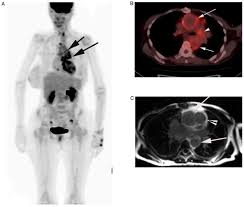 Best FDG PET CT Scan in Green Park