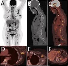 Best FDG PET CT Scan in Green Park