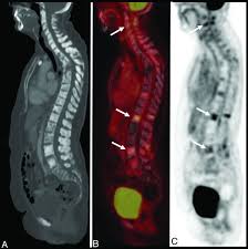 Best FDG PET CT Scan in Greater Kailash