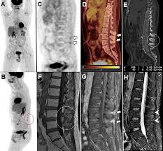Best FDG PET CT Scan in Greater Kailash
