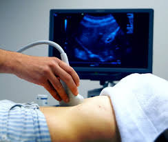 Best Ultrasound Scan Centre in Rohini Sec18-19